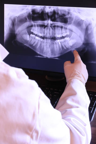 Best Emergency Treatment for Dental Infections or Abscesses in Brighton, CO